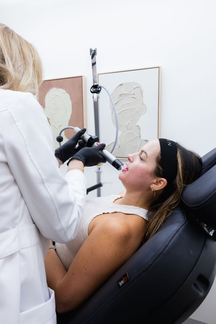 Genius RF Microneedling