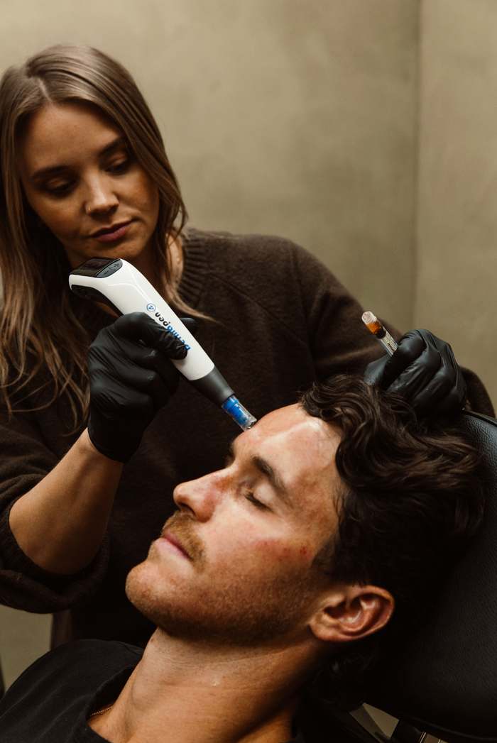 Microneedling